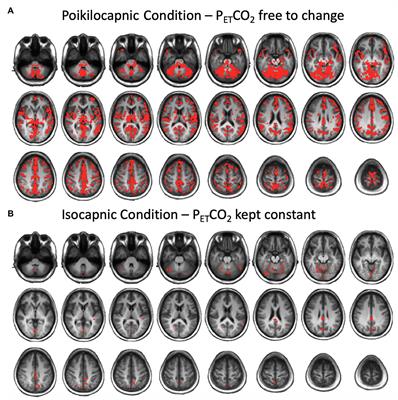 The Effect of CO2 on Resting-State Functional Connectivity: Isocapnia vs. Poikilocapnia